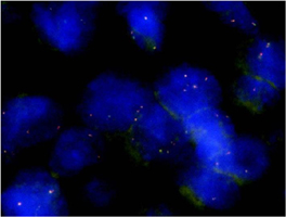 Fluorescent <i>In Situ</i> Hybridization (Formalin/PFA-fixed paraffin-embedded sections)