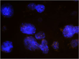 Fluorescent <i>In Situ</i> Hybridization (Formalin/PFA-fixed paraffin-embedded sections) 