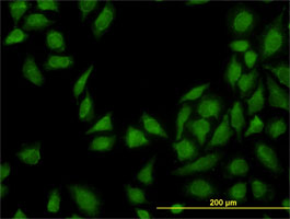 Immunofluorescence