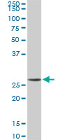 Western Blot (Cell lysate)