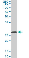 Western Blot (Cell lysate)