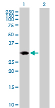 Western Blot (Transfected lysate)