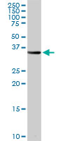 Western Blot (Tissue lysate)