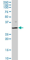 Western Blot (Tissue lysate)