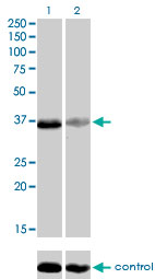 RNAi Knockdown (Antibody validated)