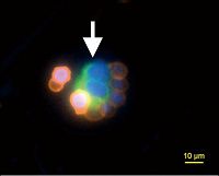 Immunofluorescence (Circulating Tumor Cell)