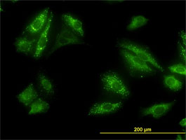 Immunofluorescence
