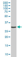 Western Blot (Cell lysate)