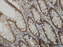 Immunohistochemistry (Formalin/PFA-fixed paraffin-embedded sections)