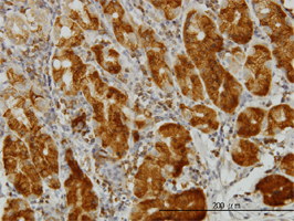 Immunohistochemistry (Formalin/PFA-fixed paraffin-embedded sections)