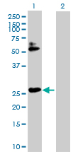 Western Blot (Transfected lysate)