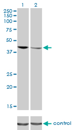 RNAi Knockdown (Antibody validated)