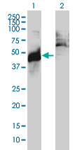 Western Blot (Transfected lysate)