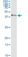 Immunoprecipitation