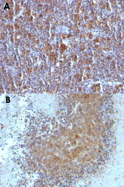 Immunohistochemistry (Formalin/PFA-fixed paraffin-embedded sections)
