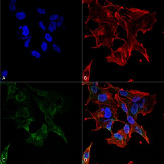 Immunocytochemistry