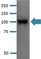 Western Blot (Tissue lysate)
