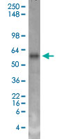 Western Blot (Tissue lysate)