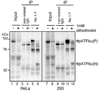 Immunoprecipitation