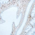 Immunohistochemistry (Formalin/PFA-fixed paraffin-embedded sections)