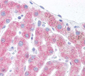 Immunohistochemistry