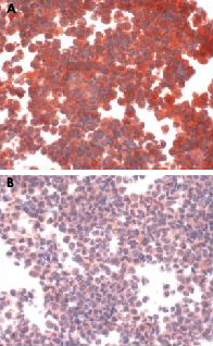 Immunocytochemistry