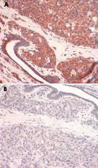 Immunohistochemistry (Formalin/PFA-fixed paraffin-embedded sections)