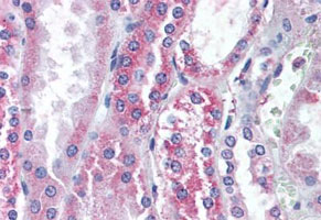 Immunohistochemistry (Formalin/PFA-fixed paraffin-embedded sections)