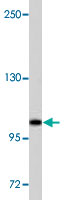Western Blot (Cell lysate)