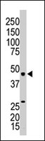 Western Blot (Tissue lysate)