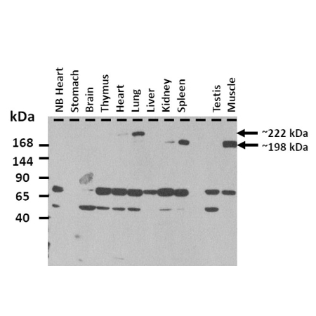 Western Blot