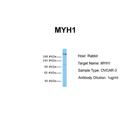 Human OVCAR-3
