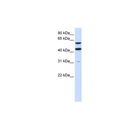 Human 293T