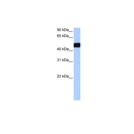 Human MCF-7