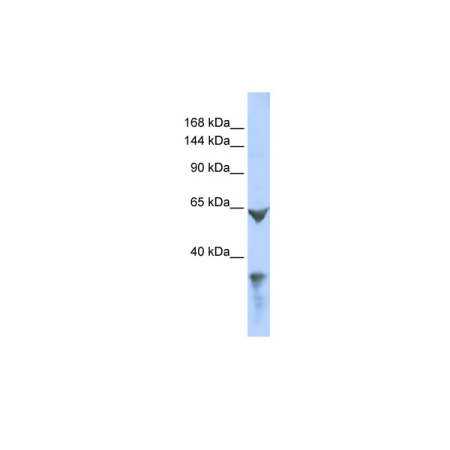 Human 293T