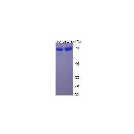 SDS-PAGE
