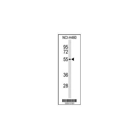 NCI-H460