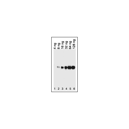 E Coli
