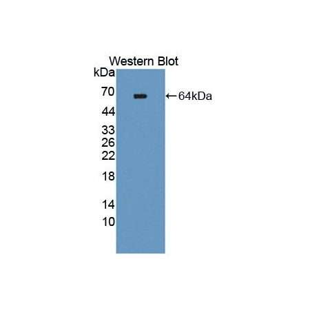 Endothelial-specific receptor tyrosine kinase