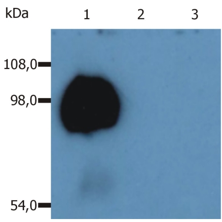 Peripheral blood lymphocytes