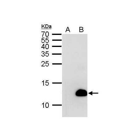 E. coli