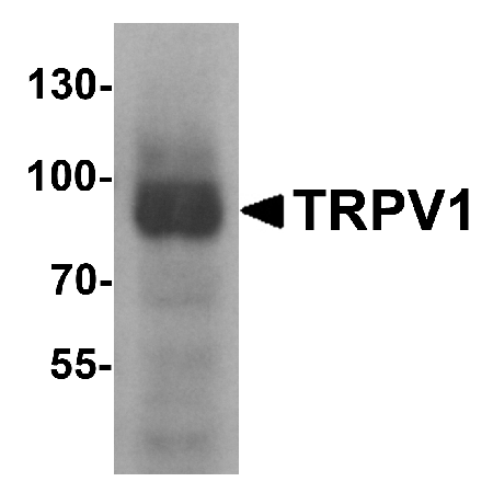 K562 cell lysate