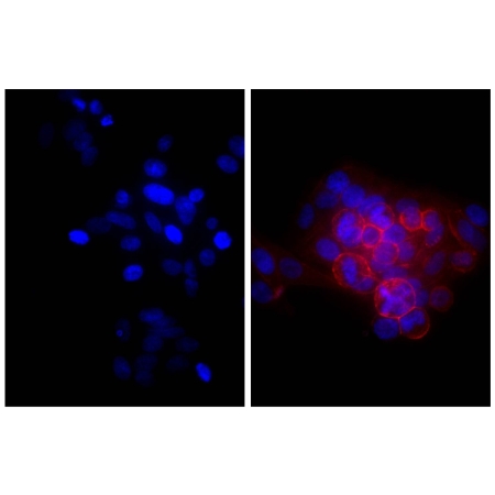 Human epithelial carcinoma cell line HEp-2