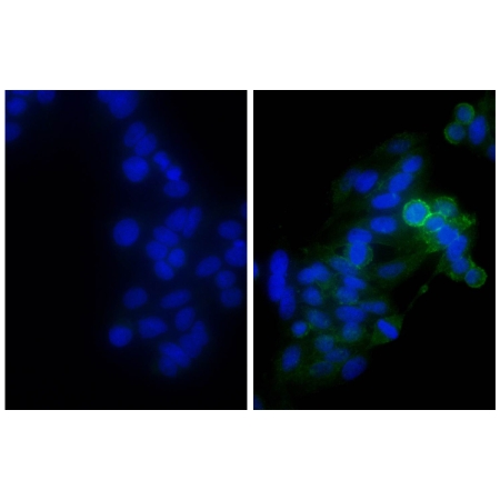 Human epithelial carcinoma cell line HEp-2