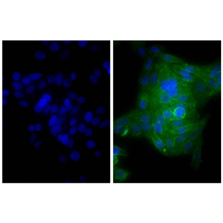 Human epithelial carcinoma cell line HEp-2