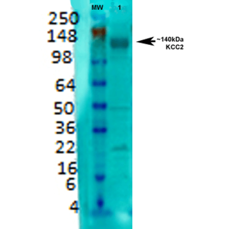 Western Blot