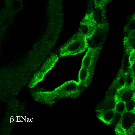 Western Blot