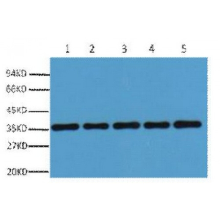 Western Blot