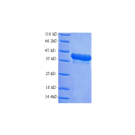 Protein SDS-PAGE