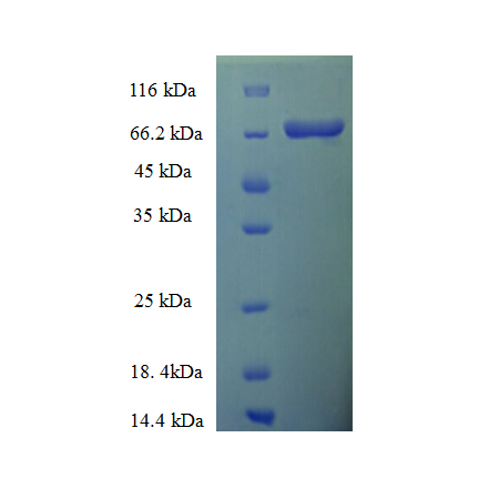 Protein SDS-PAGE